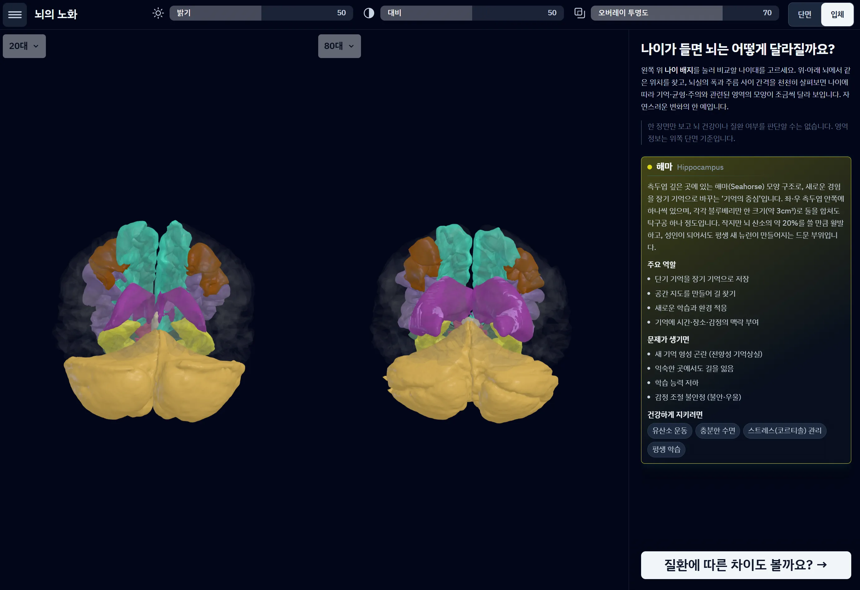 MR.Brain-Edu의 실제 화면 캡처. 20대와 80대의 3D 뇌 구조를 비교하고 오른쪽에서 해마 설명을 보여 줍니다.